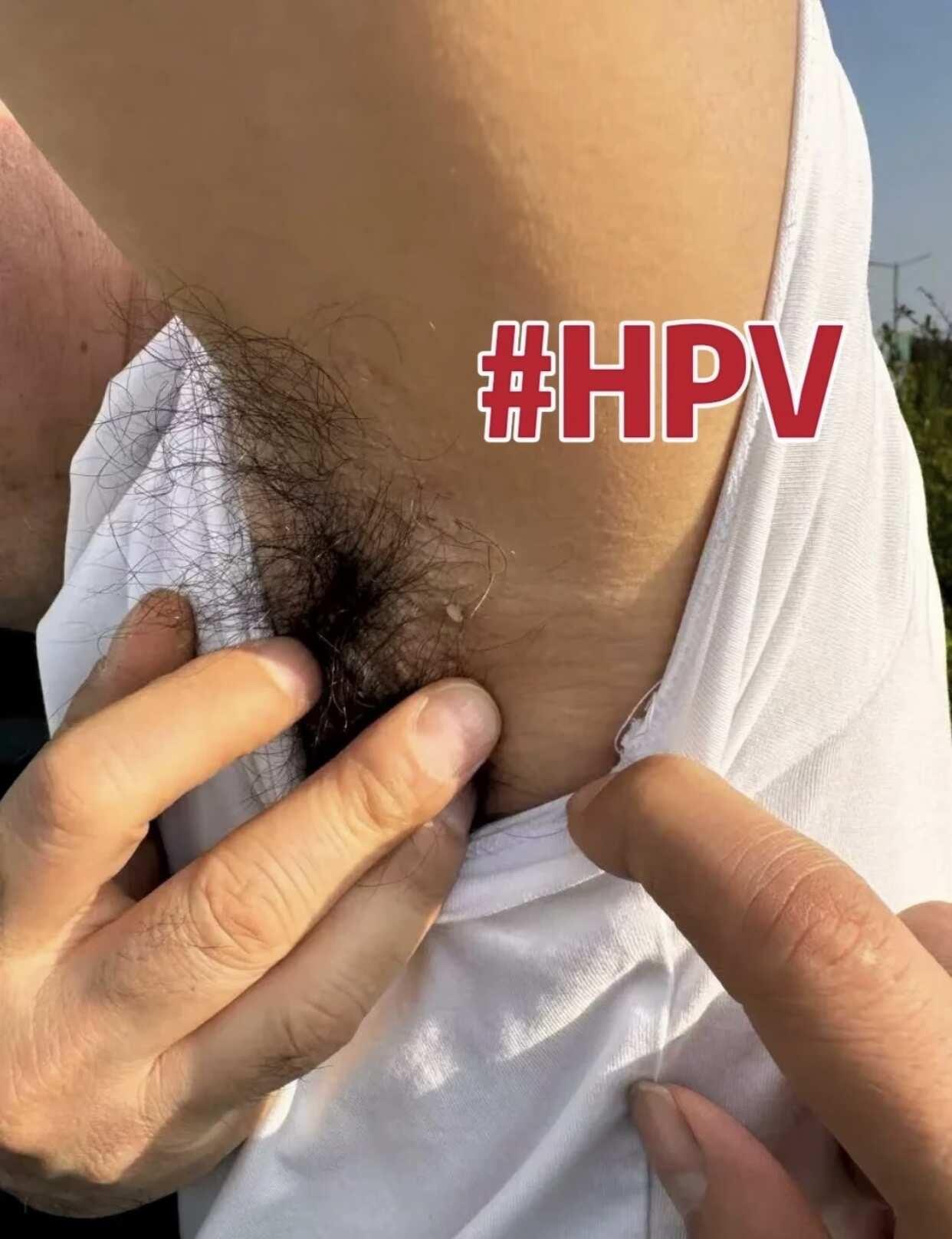 误打误撞发现的，真的巨🐮！
【请按照产品说明书正确使用】
【如有疑问请咨询专业