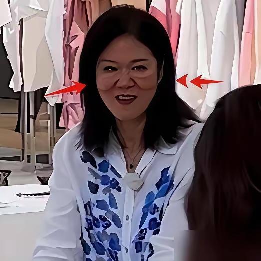 你们说，郎平的眼袋是不是年轻时打球太用力，肌肉过于松弛了？运动员为了荣誉，真的是