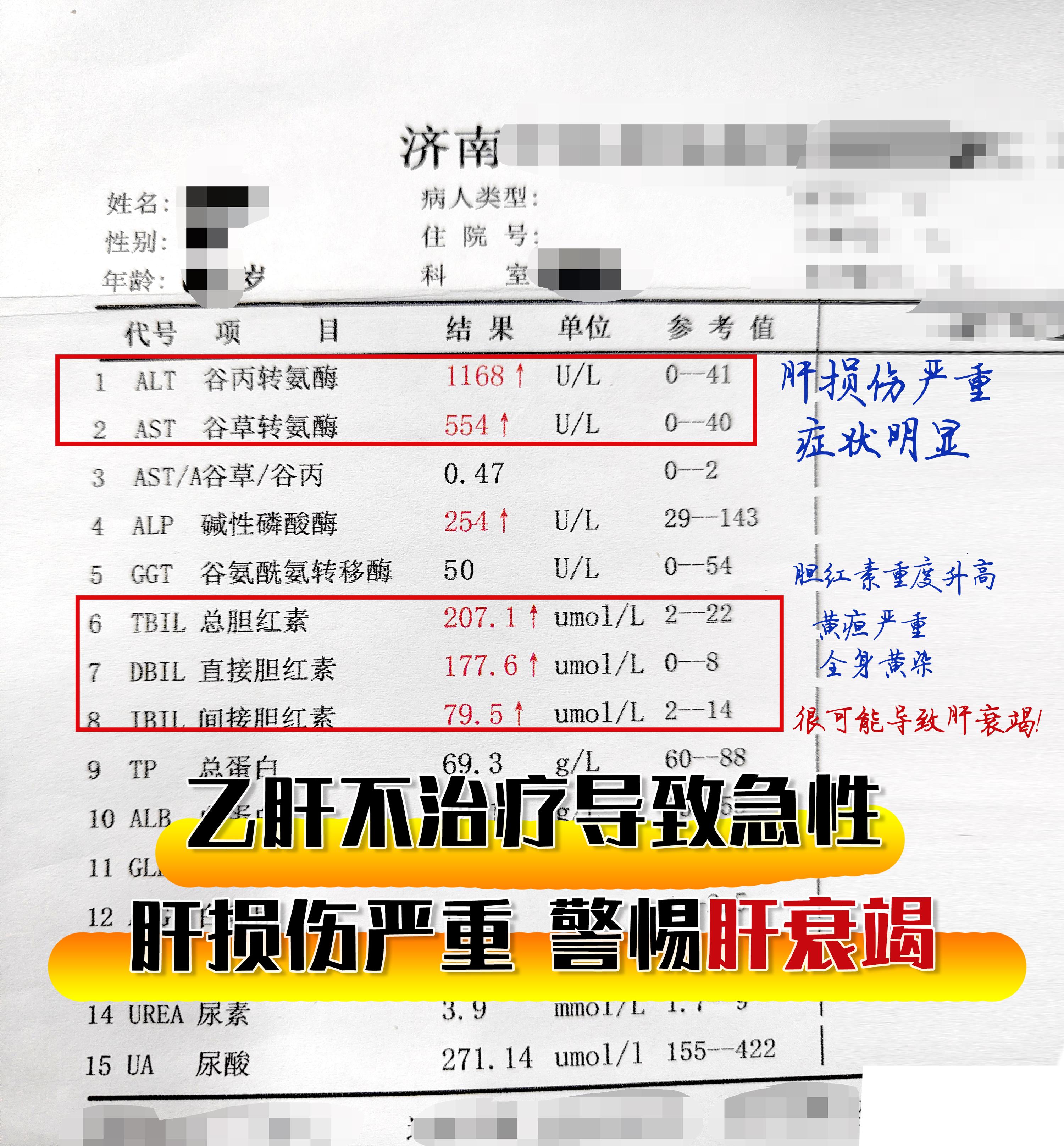 这是一位有基础肝病的患者，乙肝不治疗，导致肝损伤严重，谷丙转氨酶升高到...