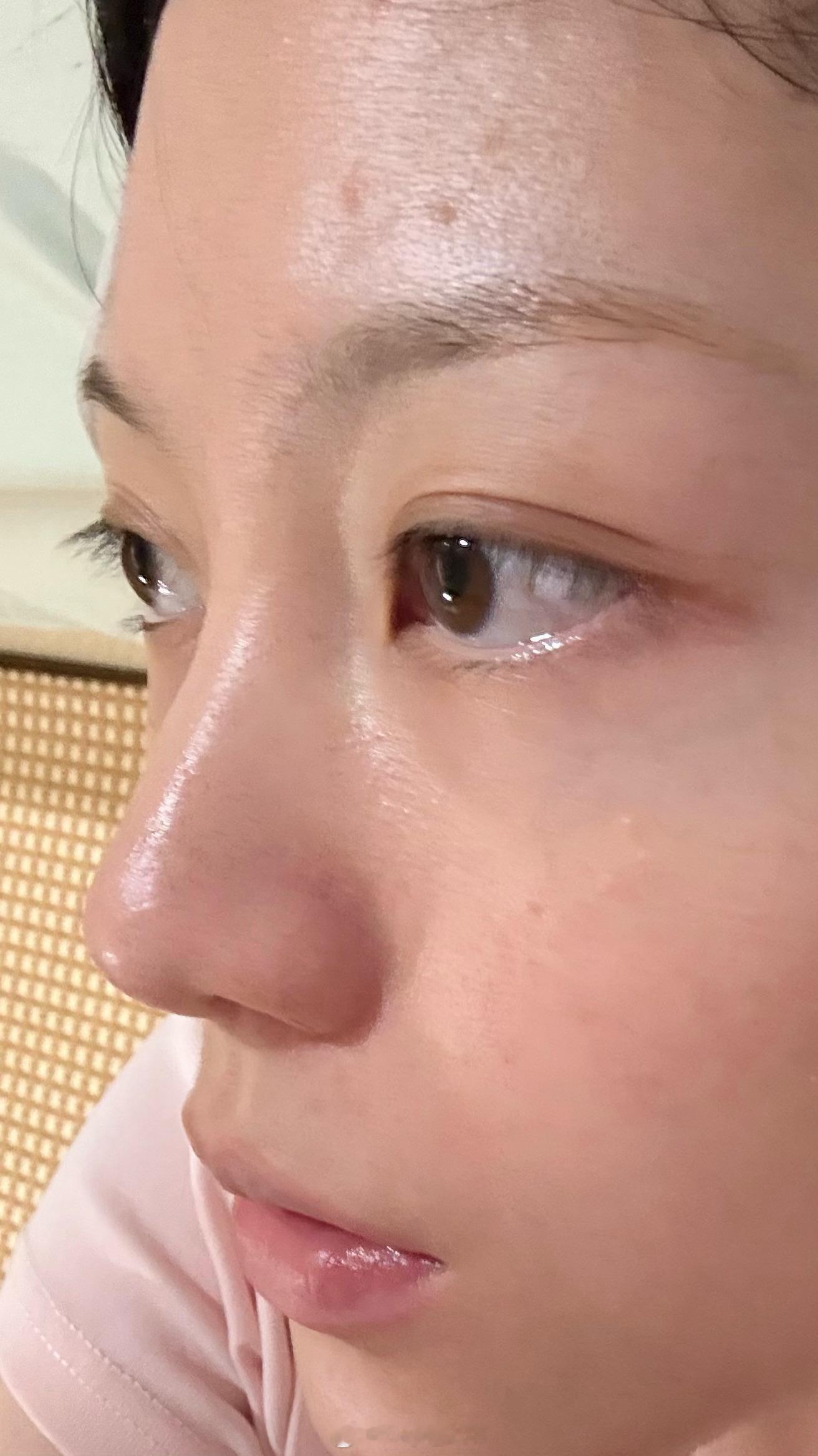 最近一天两杯奶茶的放纵给我带来了一脸闭口的同时也带来了好气色