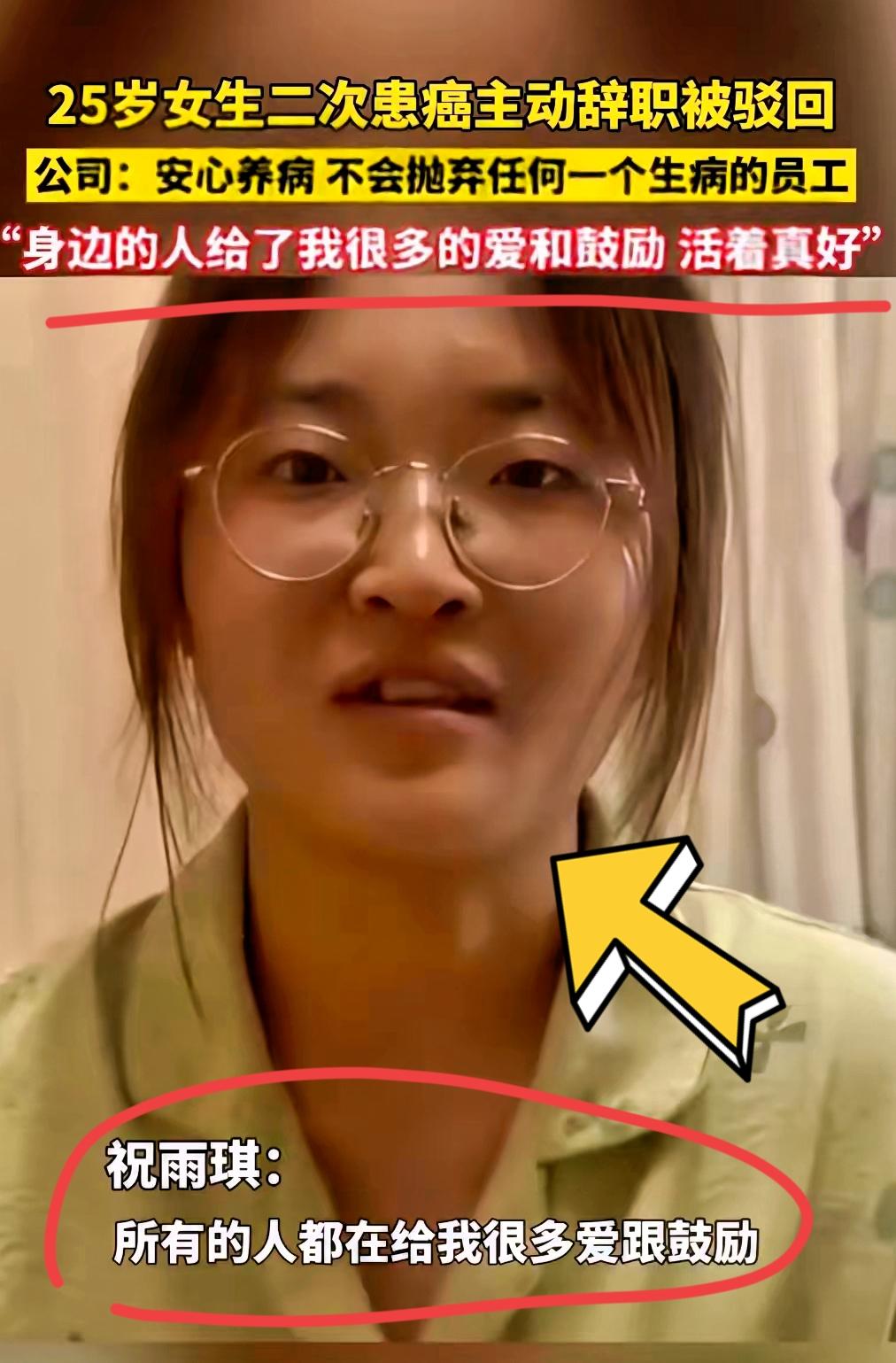 浙江衢州25岁姑娘祝乙琪，直肠癌晚期。怕化疗拖累公司，她主动递了辞职信，想体面退