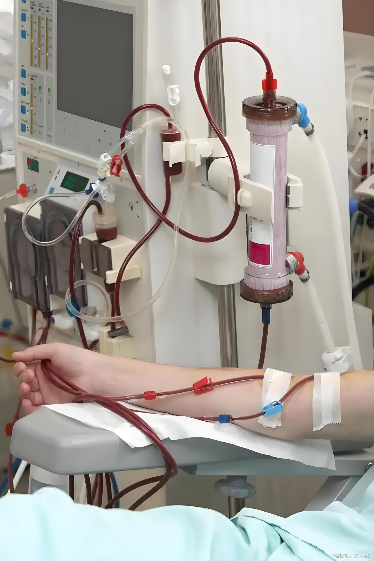 我一个当医生的叔叔跟我说了一个案例，让我再也不敢喝饮料了。

他说，他们医院来了