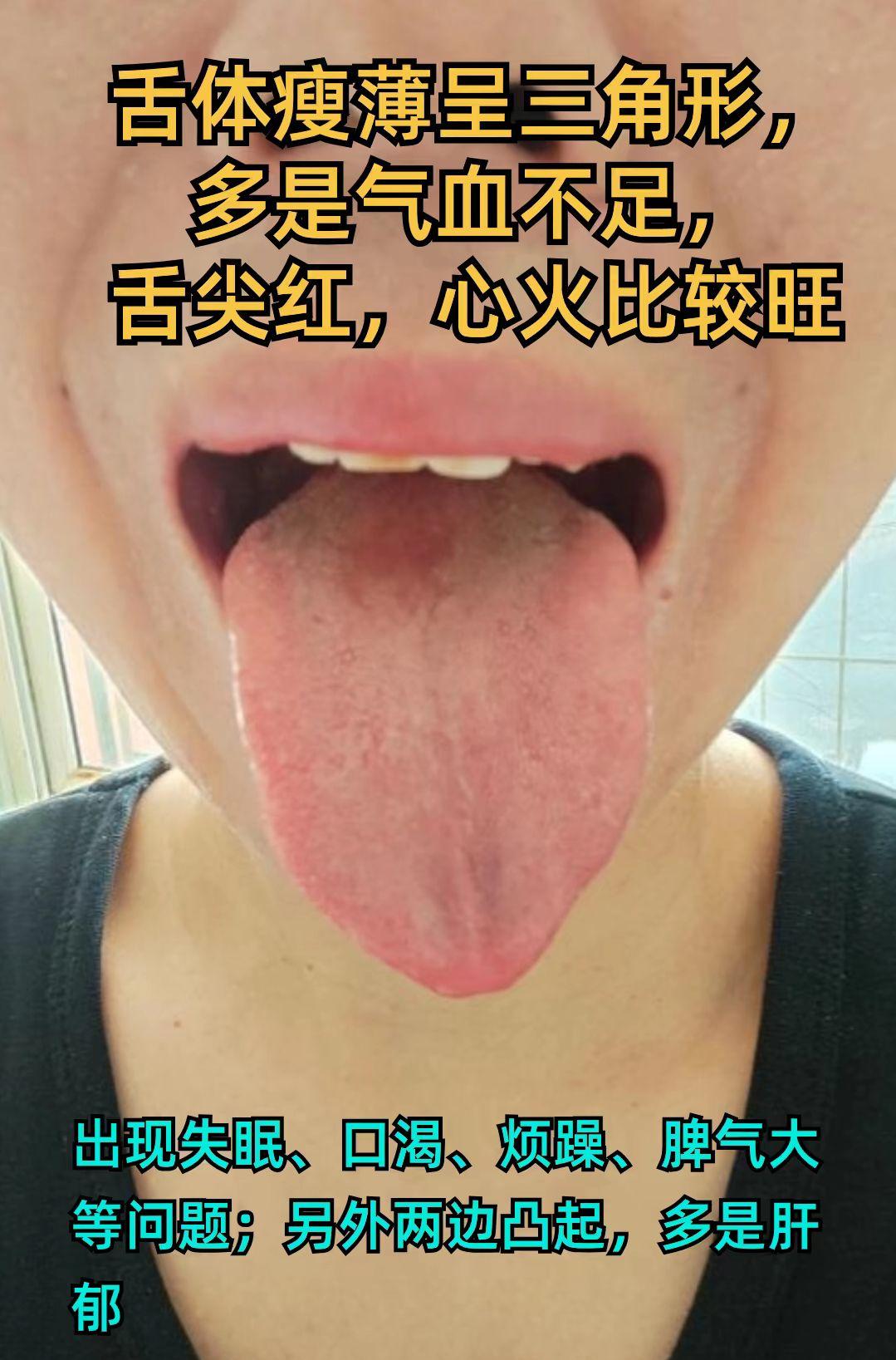 想知道自己是什么类型舌象 对照看看吧