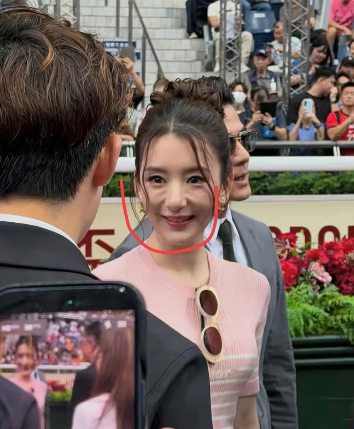 天王的老婆笑起来怎么脸部感觉怪怪的？
