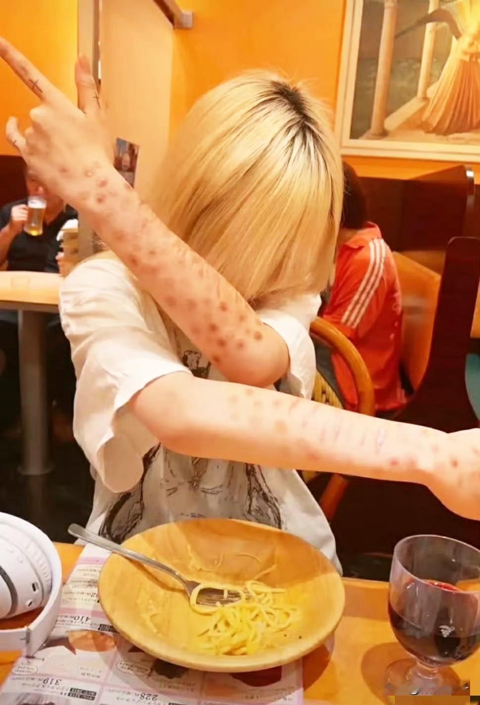 日本年轻人聚众晒梅毒？[震惊]
这是最恶心的，不以为耻，反以为荣，当他们把这个当