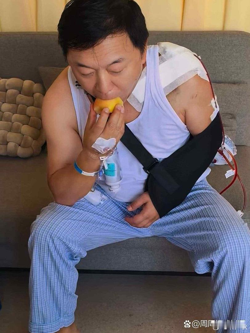 黄渤手臂骨折还没恢复，又把锁骨摔骨折了 ​​​