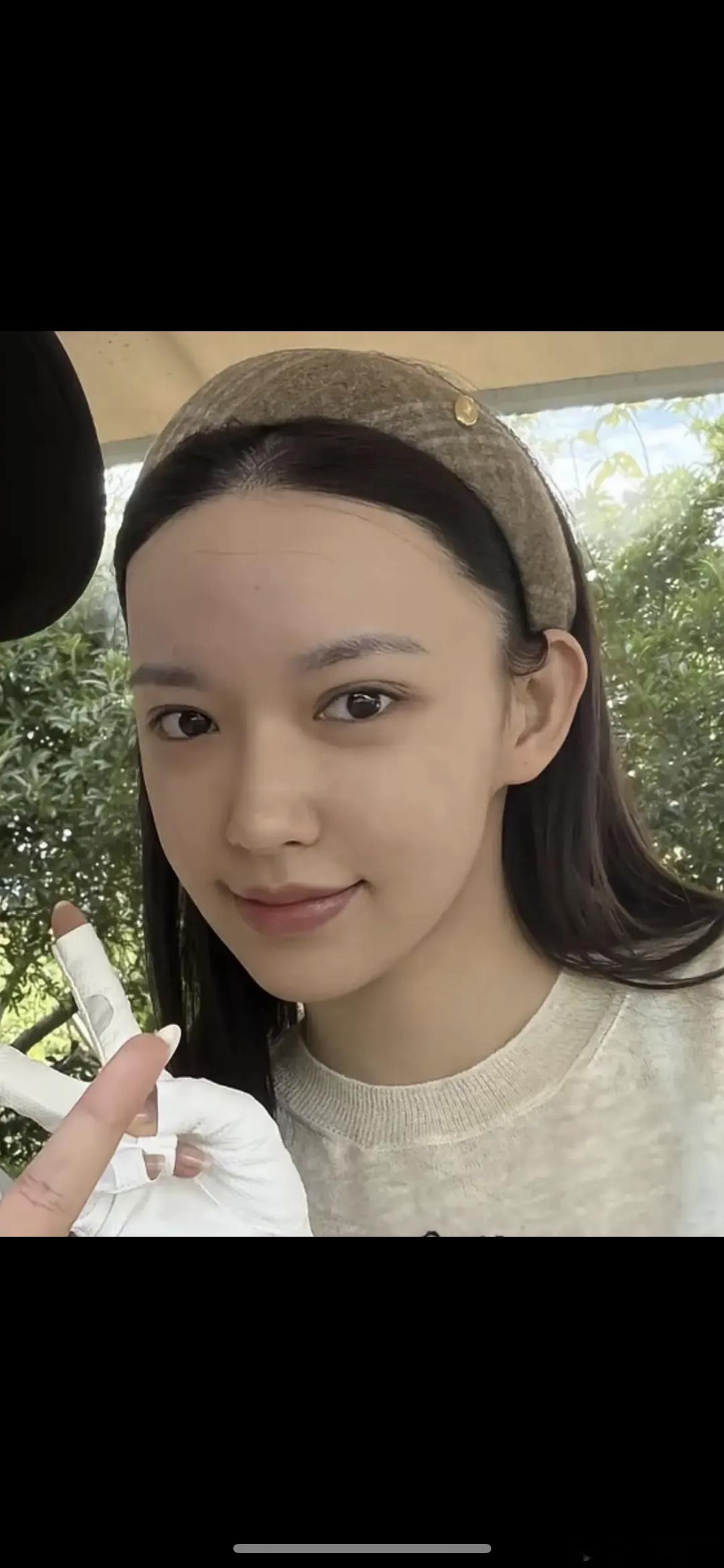 程潇发际线看起来好高