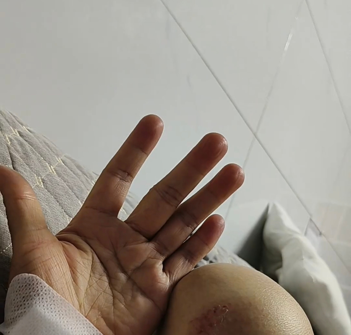 7月4日，玉林容县女子在路边披雨衣被电车撞伤了 ，当事人：下午快两点半。上班路上