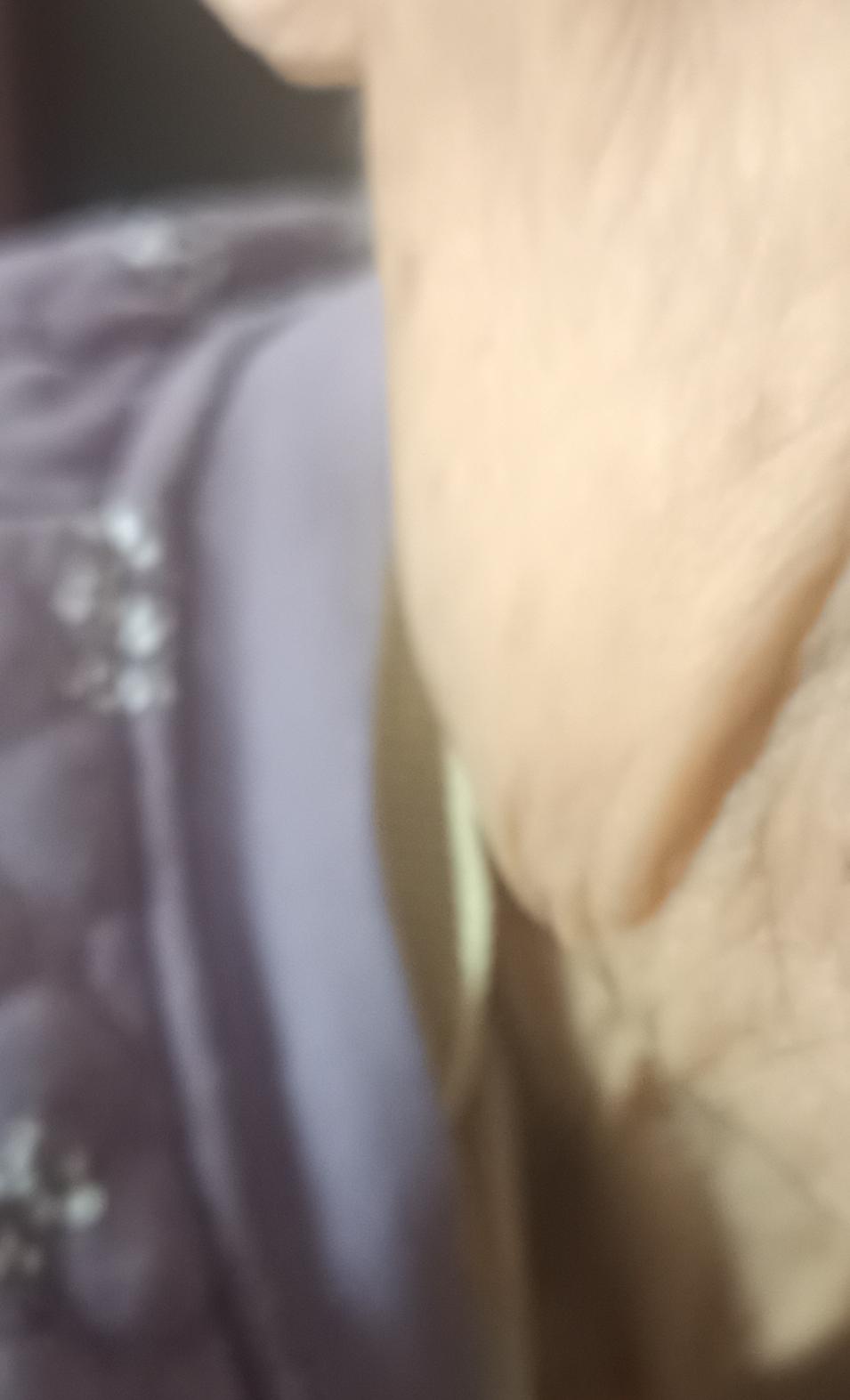 今早搀老妈去卫生间，发现右侧腮帮子已经基本消肿，也不大疼了。
从21号开始，在家