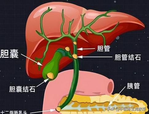 胆囊息肉总不消？你的胆囊可能“没力气”了
-
胆囊息肉≠胆囊“长痘痘！中医说：是