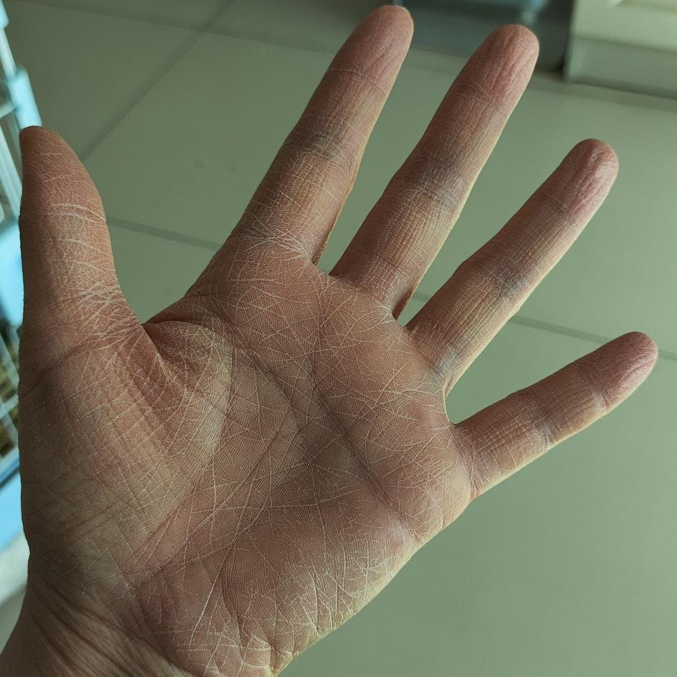 43岁中年女人的手，刚拖完地……

刚拖完地，看了一下自己的手，乱七八糟的纹路。