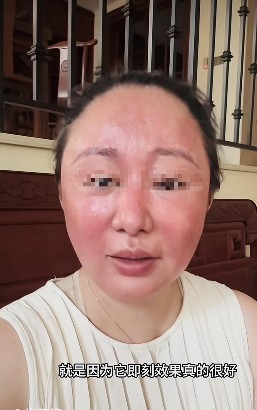 刚刚刷到网名为“杨阿姨”的账号，她对着镜头讲述了美容的亲身经历，并向大家展示了美
