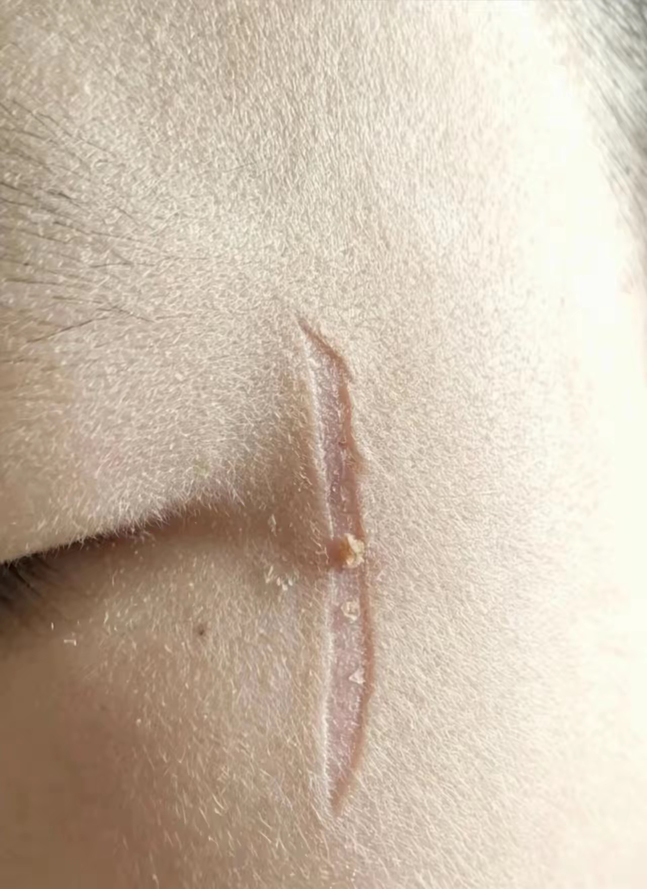 血的教训，这就是划伤不缝针的后果！丑死了，以后咋弄啊？ ​​​