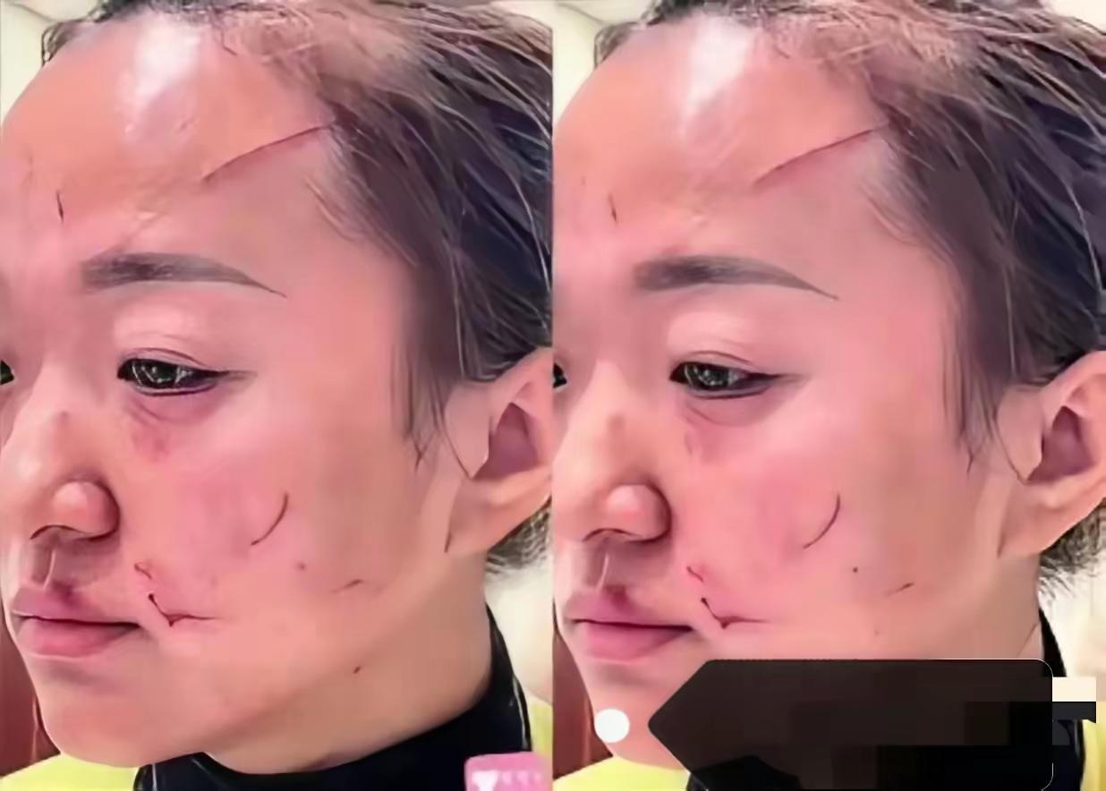 家家有本难念的经！
婆媳打架后续来了。经警察调解，婆婆拿出 5 万给媳妇，从此各