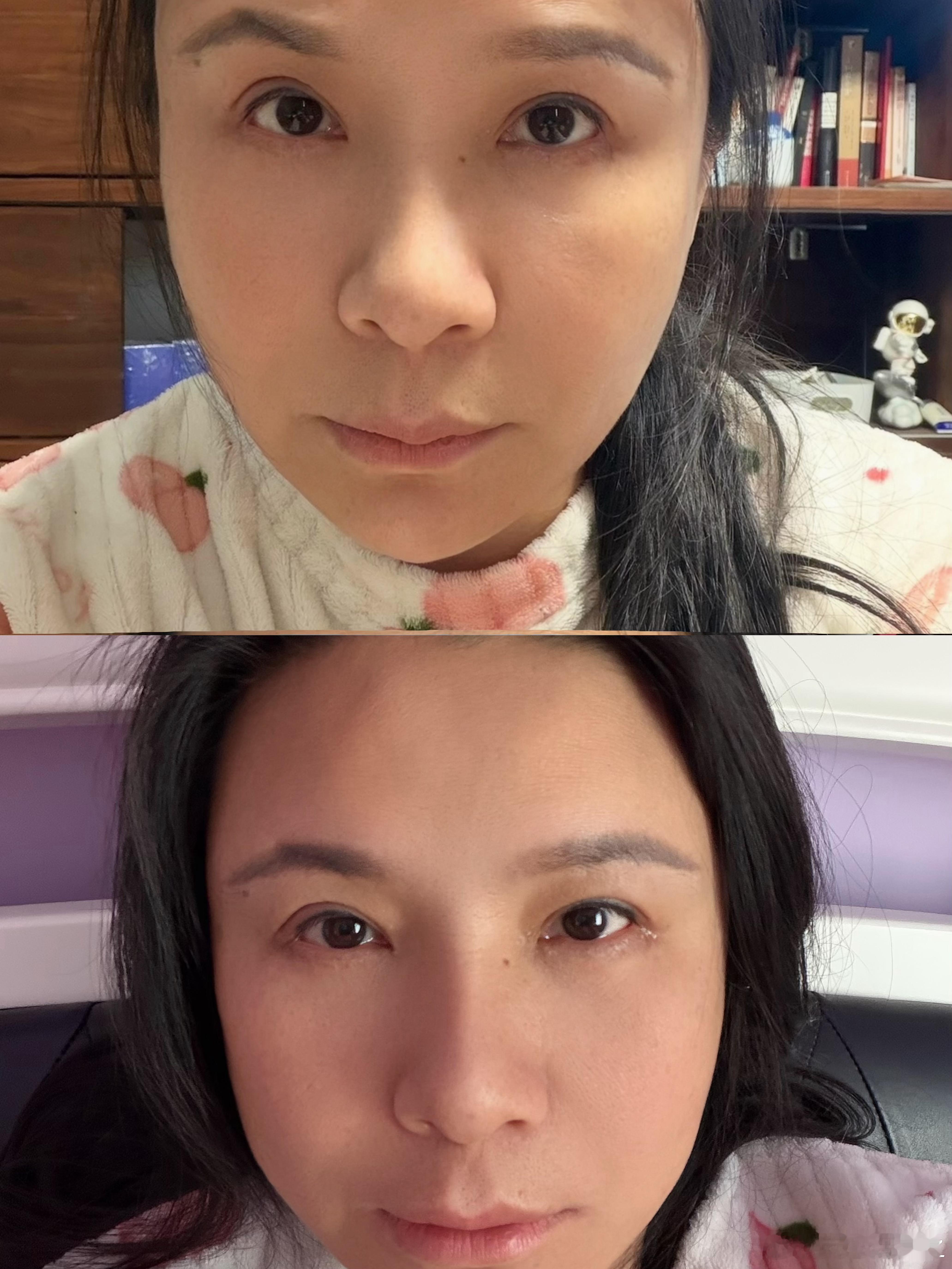 如果有人不明白PTSD-神经紧张-筋膜痉挛-肌肉拧巴-骨骼卡顿甚至被牵拉歪斜的恶