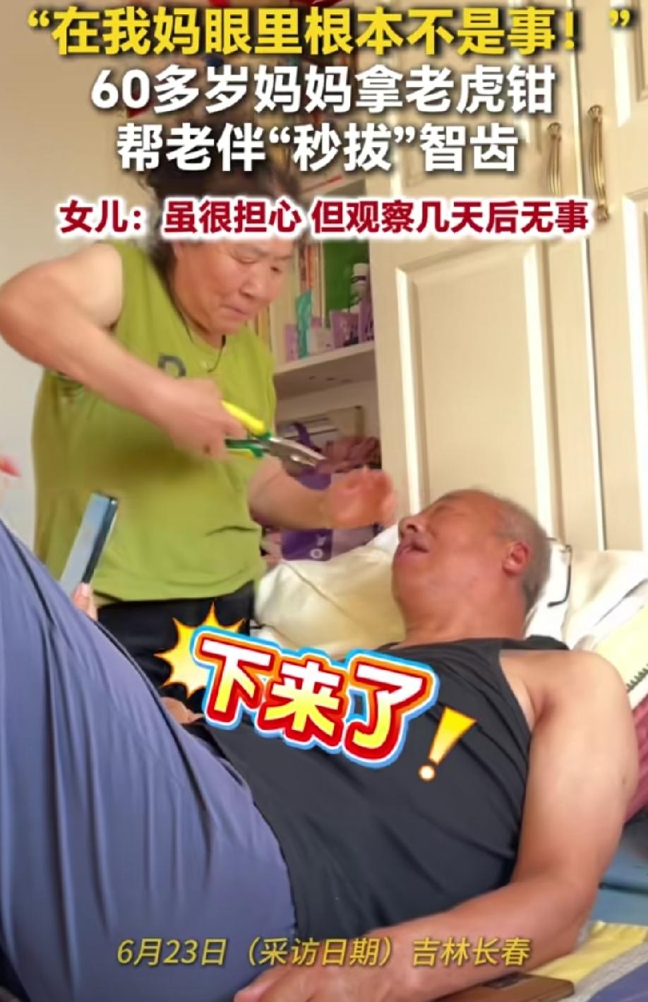 这事看的人手心冒汗！
60岁的妈妈拿老虎钳帮父亲秒拔智齿惊呆女儿，她很担心，妈妈
