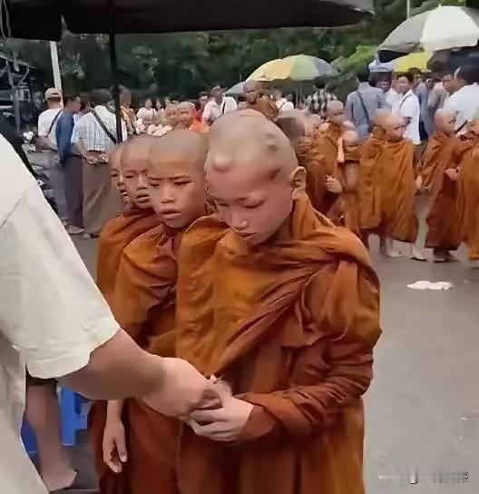 这个小和尚的脑袋上长的全是一些包，这应该是一种病，以前看到过有关资料介绍过这种病