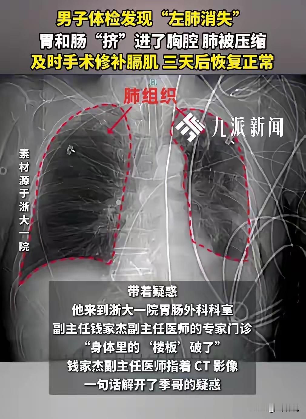 “这就是命！”浙江，一男子参加活动抽奖，意外中奖获得了一次免费体检的资格，可体检