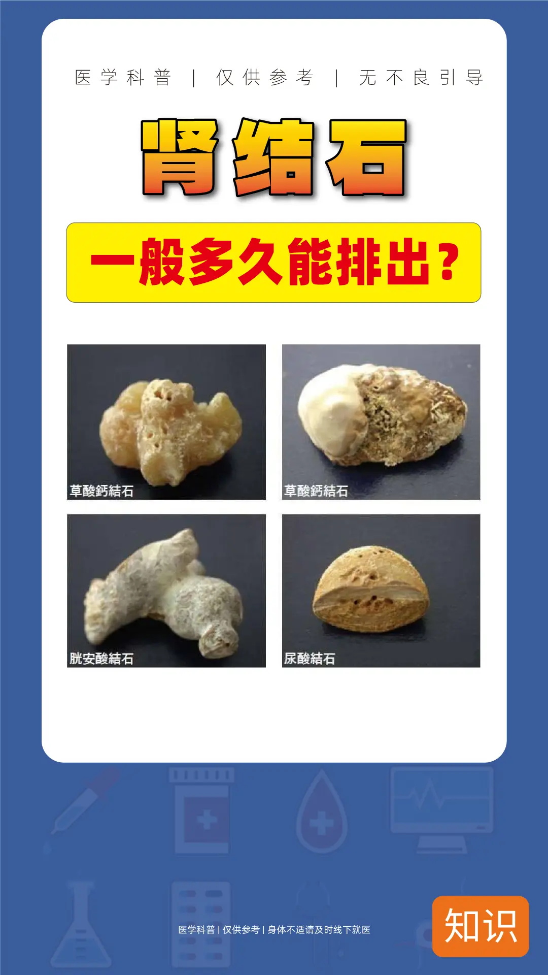 肾结石多久才可以排出来？？？看完就知道