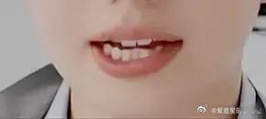 能认出这是哪位女明星的🦷吗？ 