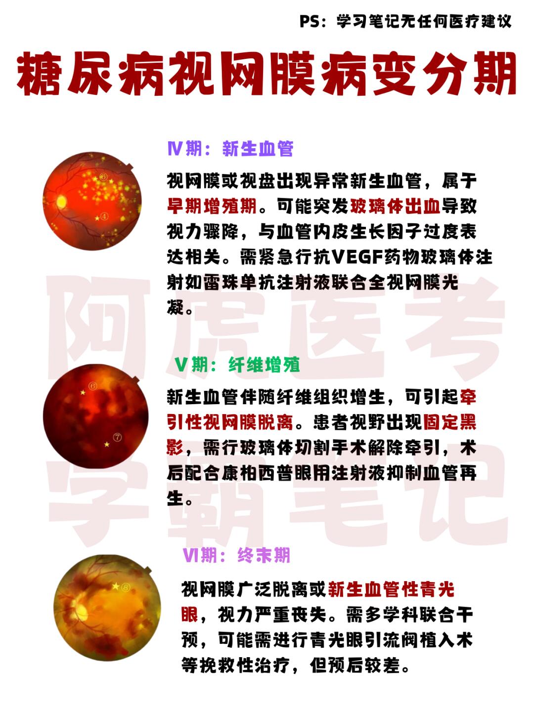 医学生笔记📒：糖尿病视网膜病变分期👆