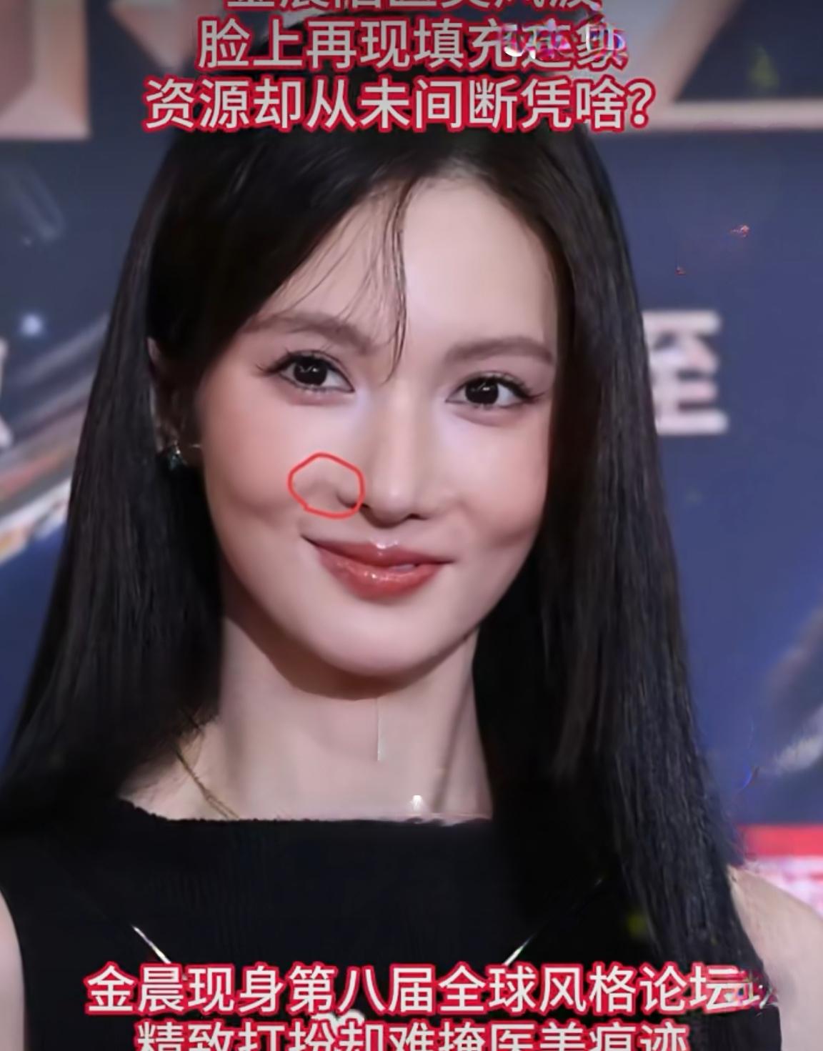 金晨也被自己的妆容丑到了[捂脸]

日前，金晨在直播中回应过度医美争议时坦言：“