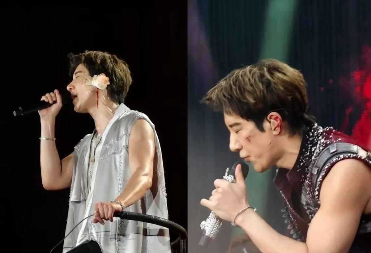 王力宏成都演唱会出事了！唱《天地龙鳞》时，被脚下威亚直接绊倒，左耳软骨碎裂，面部