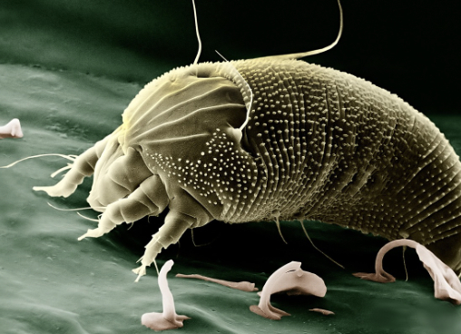 螨虫隐蔽在生活中的很多地方，对人体的危害极大，可以损害皮肤，引发炎症，传染疾病，