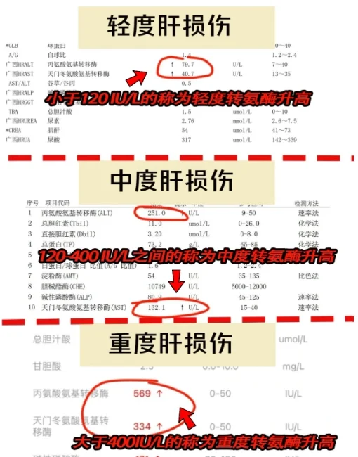 今天教给大家3招快速降酶！