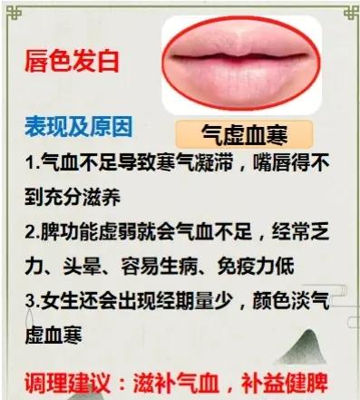 你知道吗？身体出现问题时，嘴唇会发出信号！下面这六种常见的唇色，快看看你的嘴唇属