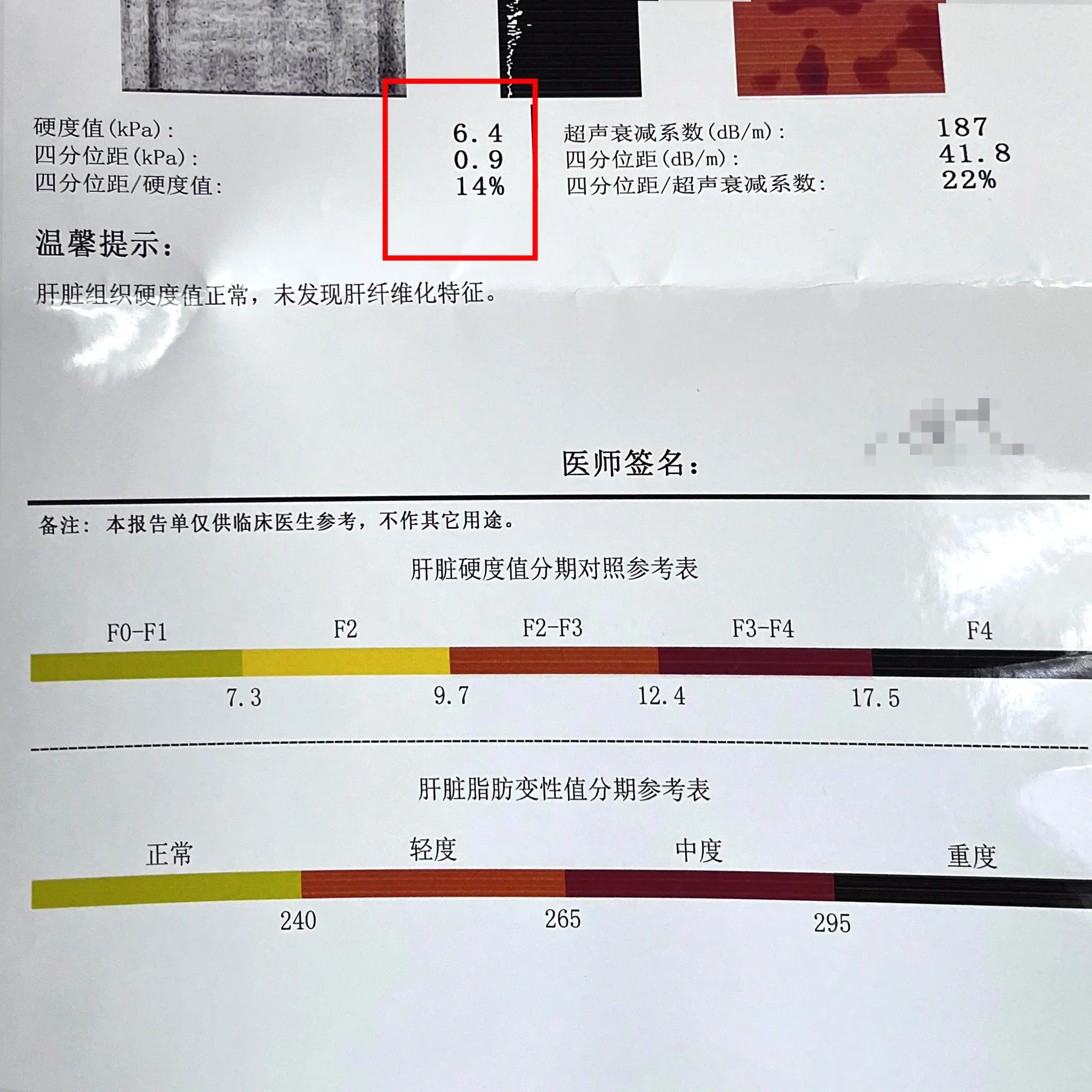 乙肝患者彩超提示肝实质回声增粗严重吗？ 医生：千万不要自己吓自己！  ...