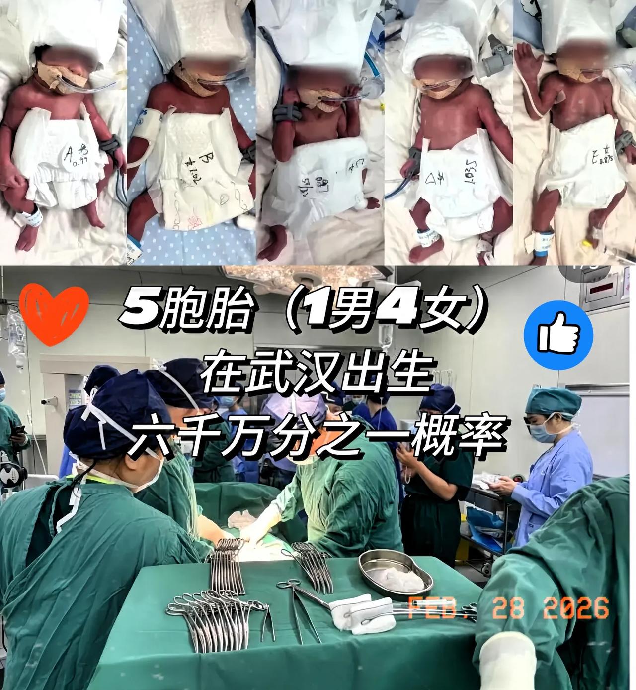 终于懂了
五胞胎妈妈为什么不远千里、跨省几千公里赶到武汉，找李家福医生接生。
 