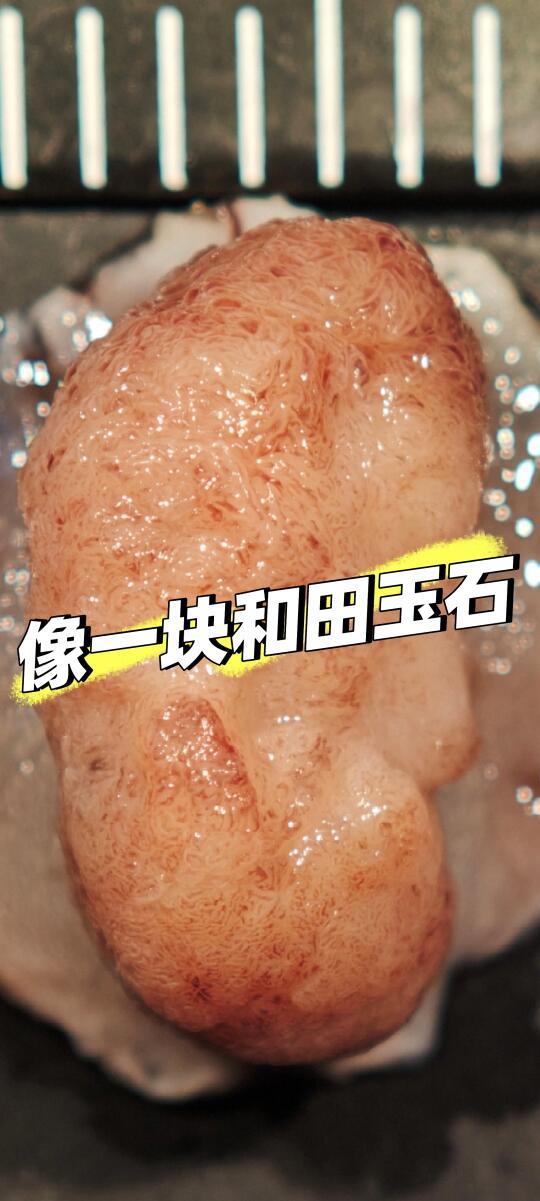 这么精美的肠息肉，你见过么？