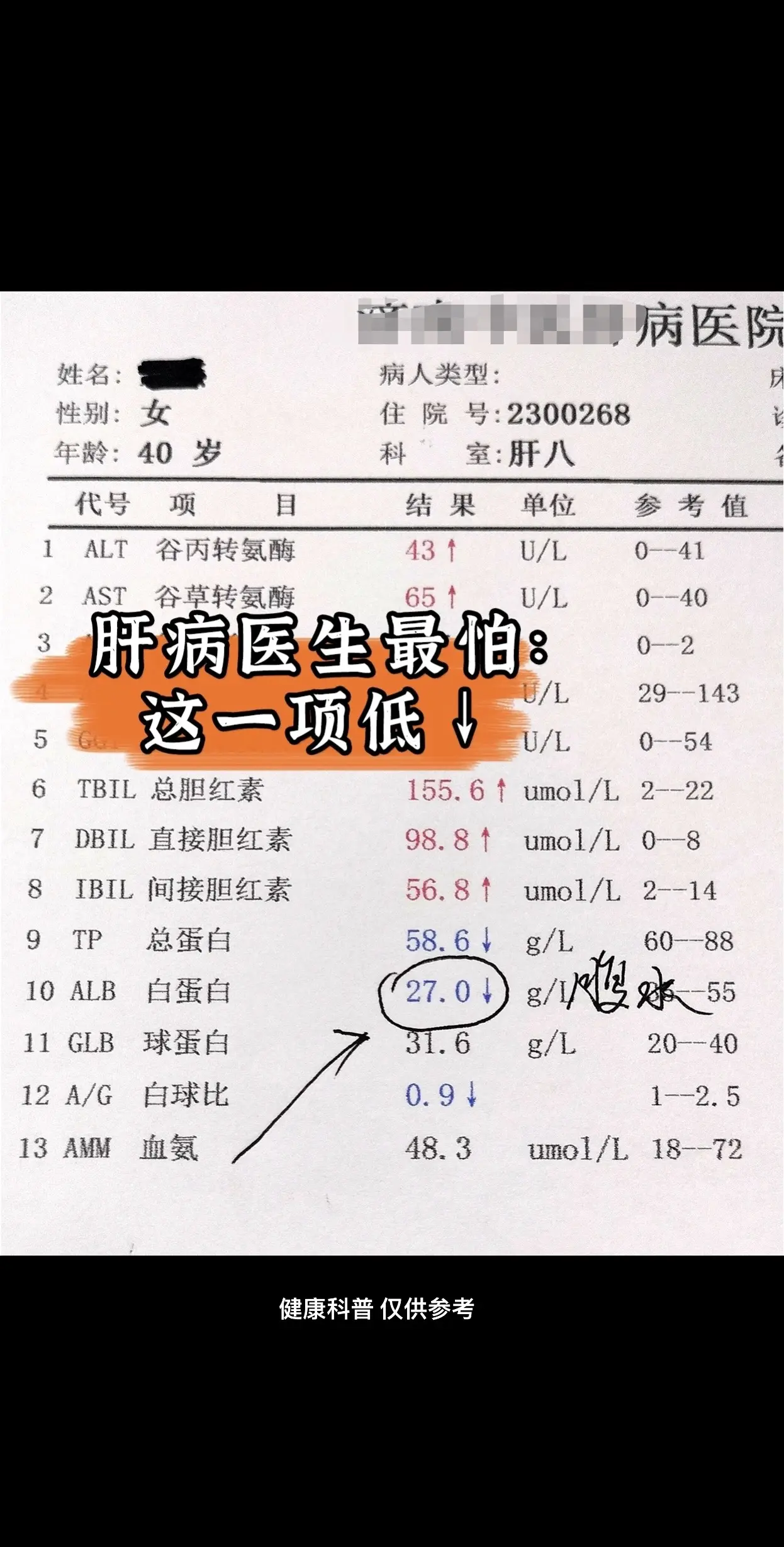 这是一位山东聊城的肝病患者的报告单，谷丙和谷草都高出正常范围，但并不是...