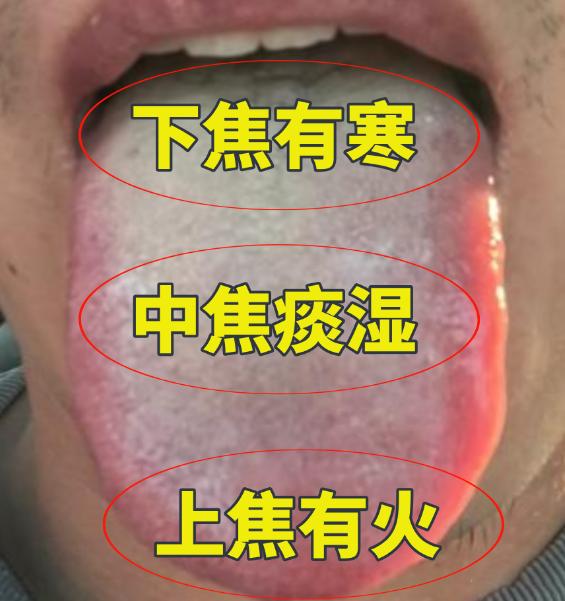 想法多，但能力差的人其实特别明显，想藏都藏不了，从舌头上一眼就能看出来！

因为