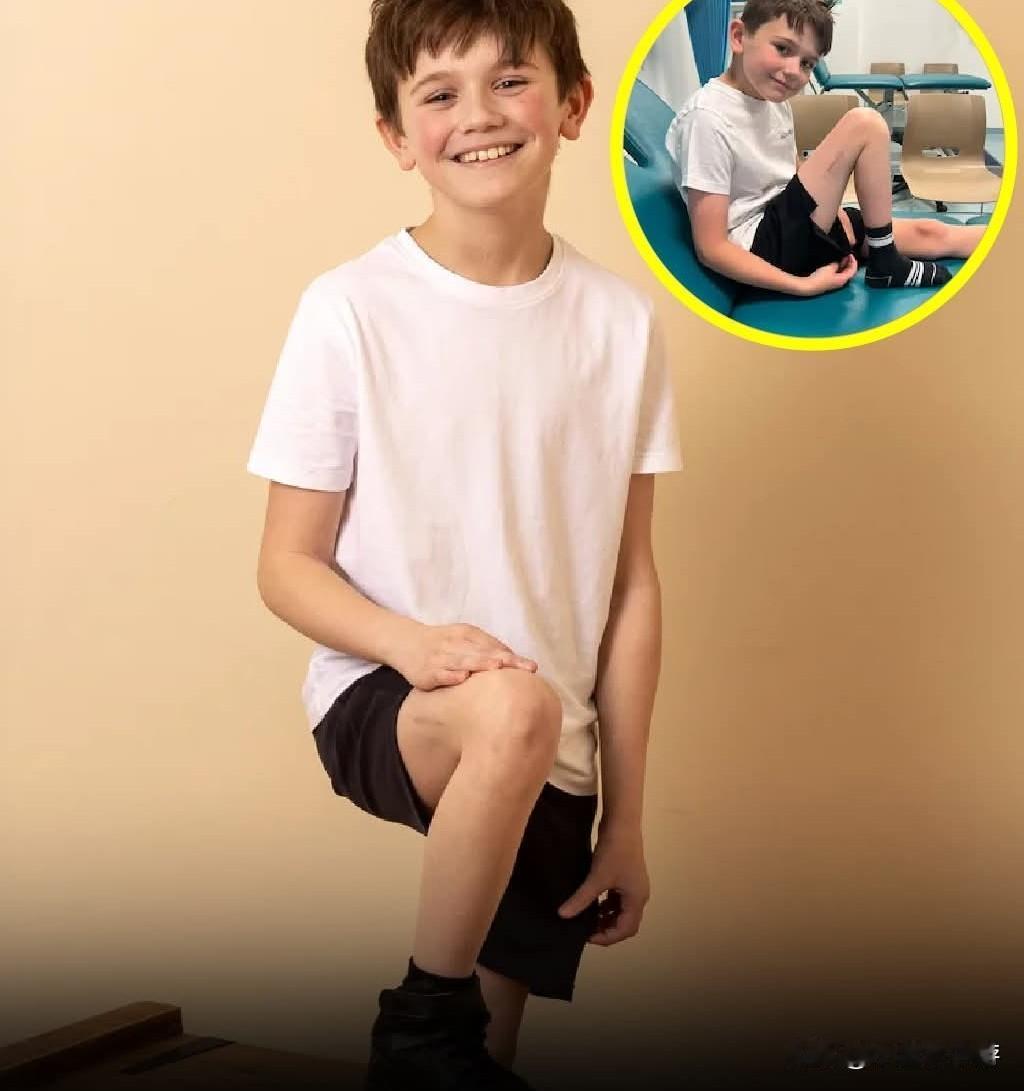 一名名叫阿尔菲·菲利普斯的九岁英国男孩在2025年成为英国首位接受创新手术以矫正