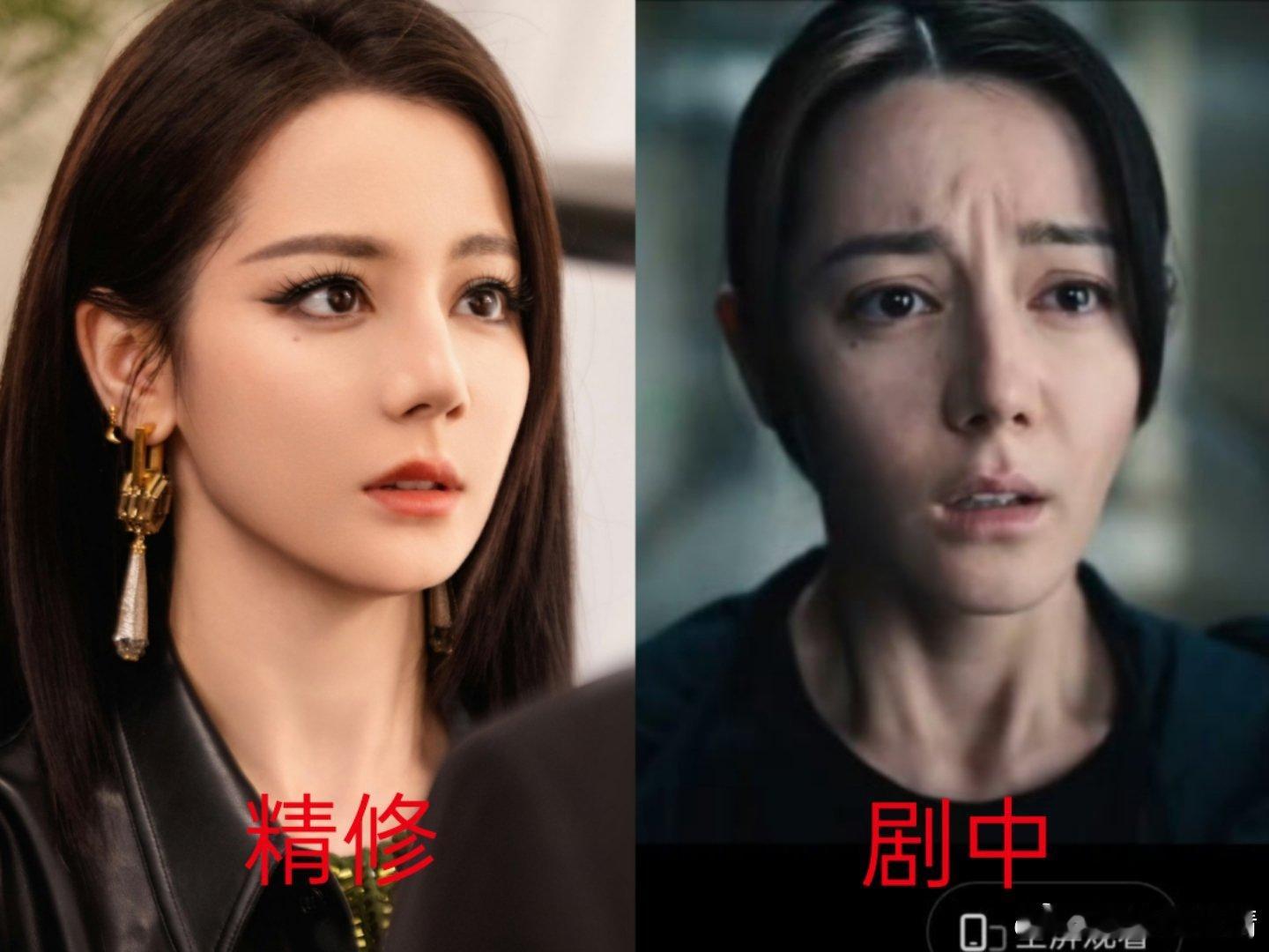 迪丽热巴回京后独自去做美容女明星爱美是应该的，建议多保养下皮肤的紧致度