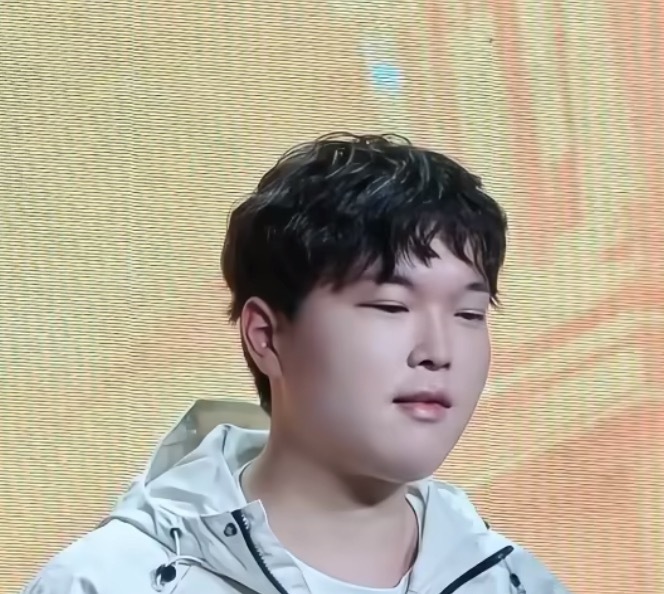 Bin的双眼皮…大家感觉怎么样…