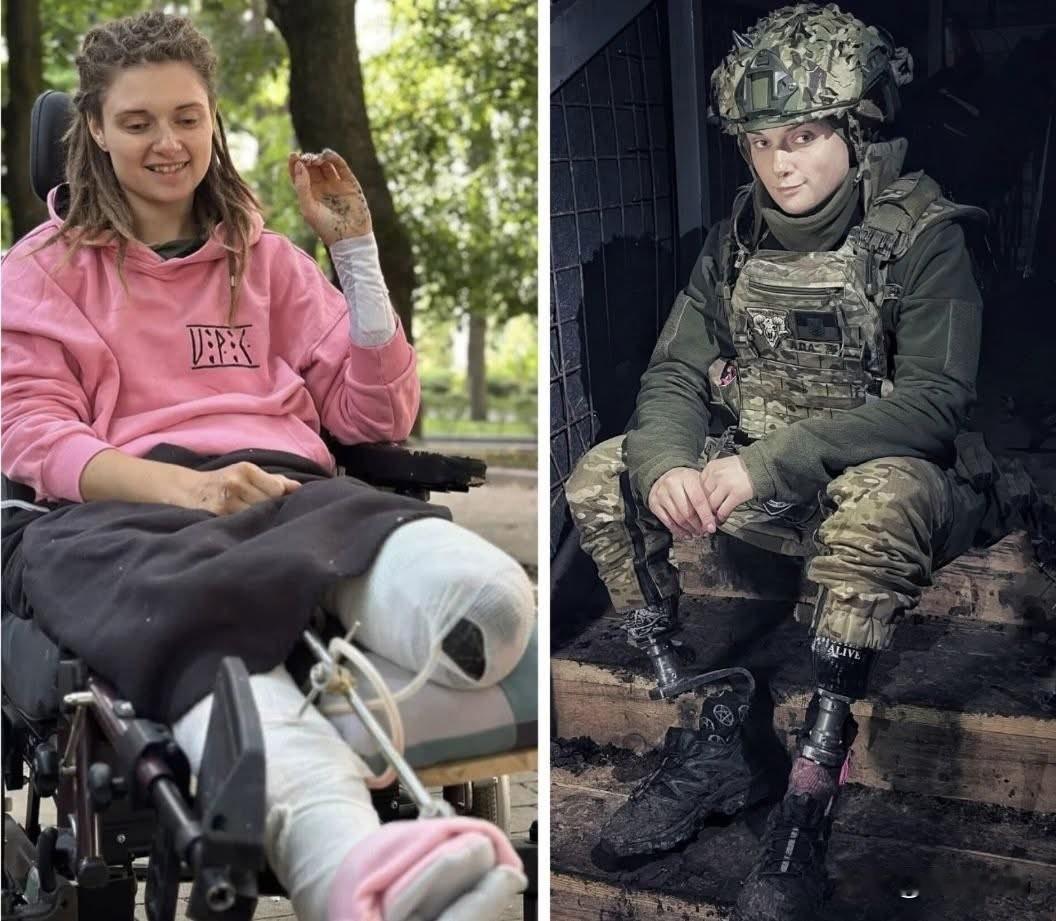 乌克兰女兵打成残疾，还要上战场！乌克兰美女士兵，双腿被炸断，经过13次手术还不能