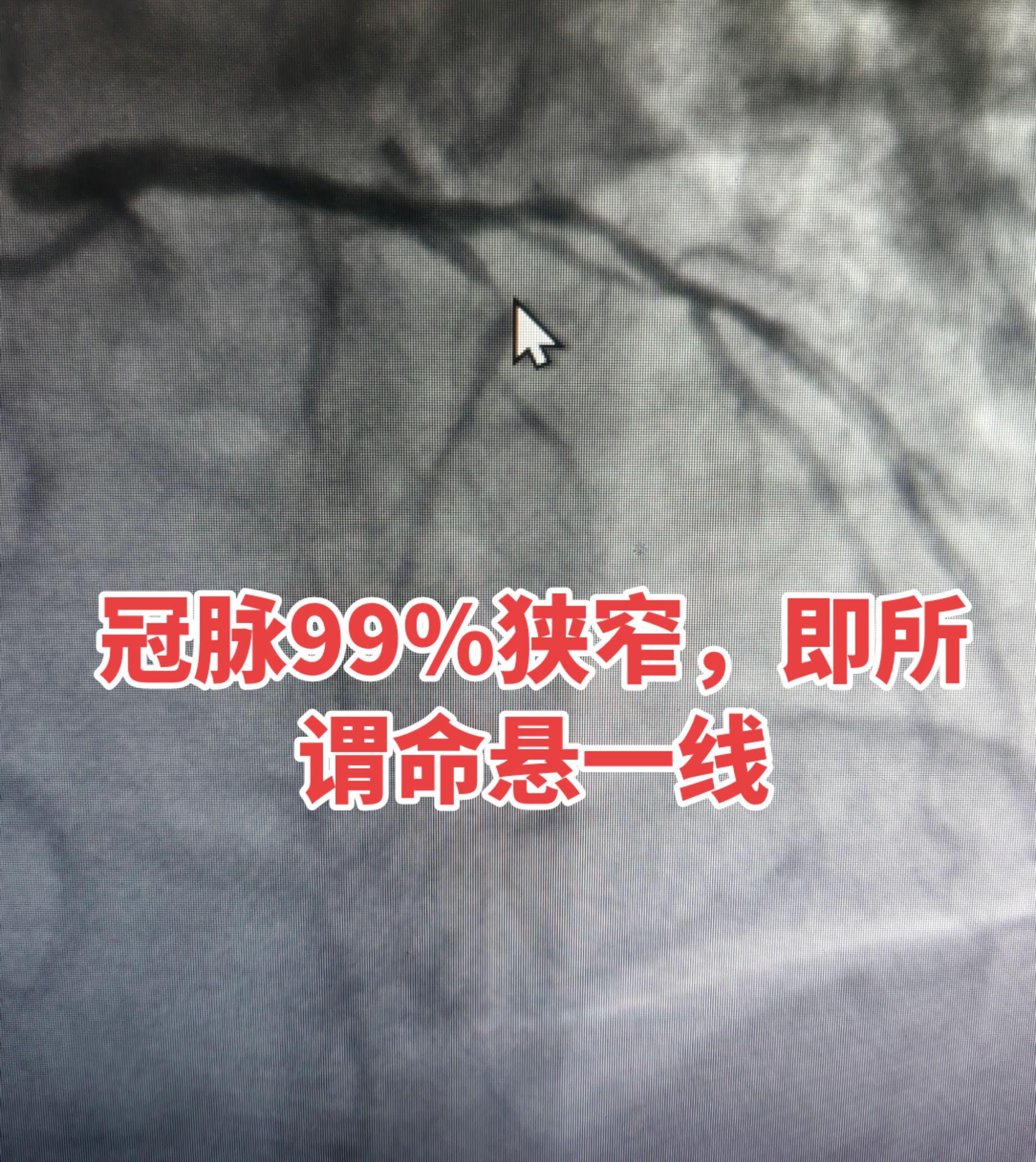 医学影像病例分享 医学科普 医学知识科普