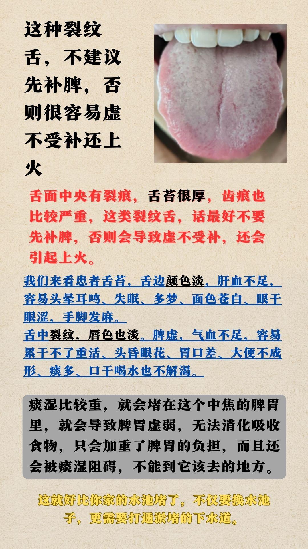 这种裂纹舌，舌面中央有裂痕，舌苔很厚，齿痕也比较严重，脾胃问题，肝血不足，气血不