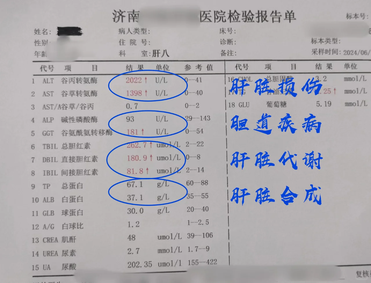 肝功能这4项指标你都了解了吗？
