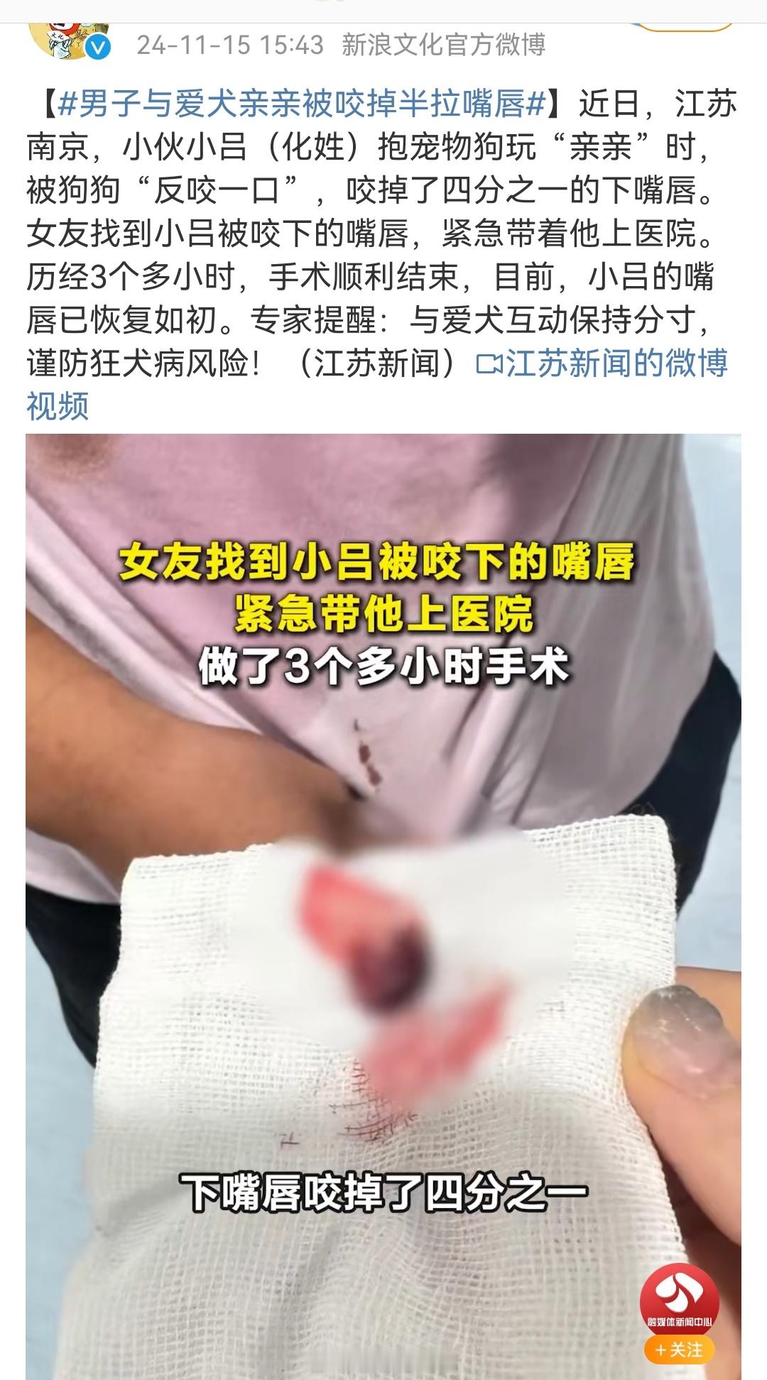 男子与爱犬亲亲被咬掉半拉嘴唇 说变脸就变脸。遇到的太多了。 