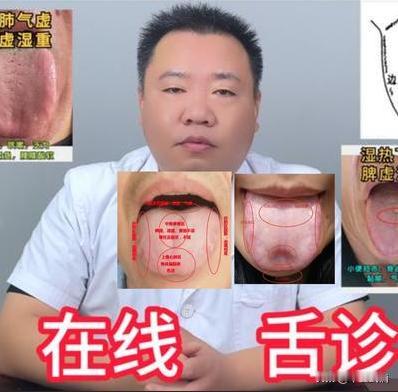 今天天气晴朗，刚好没多少人，需要看舌象的可以发在评论区
注意：照片越清晰，舌体完