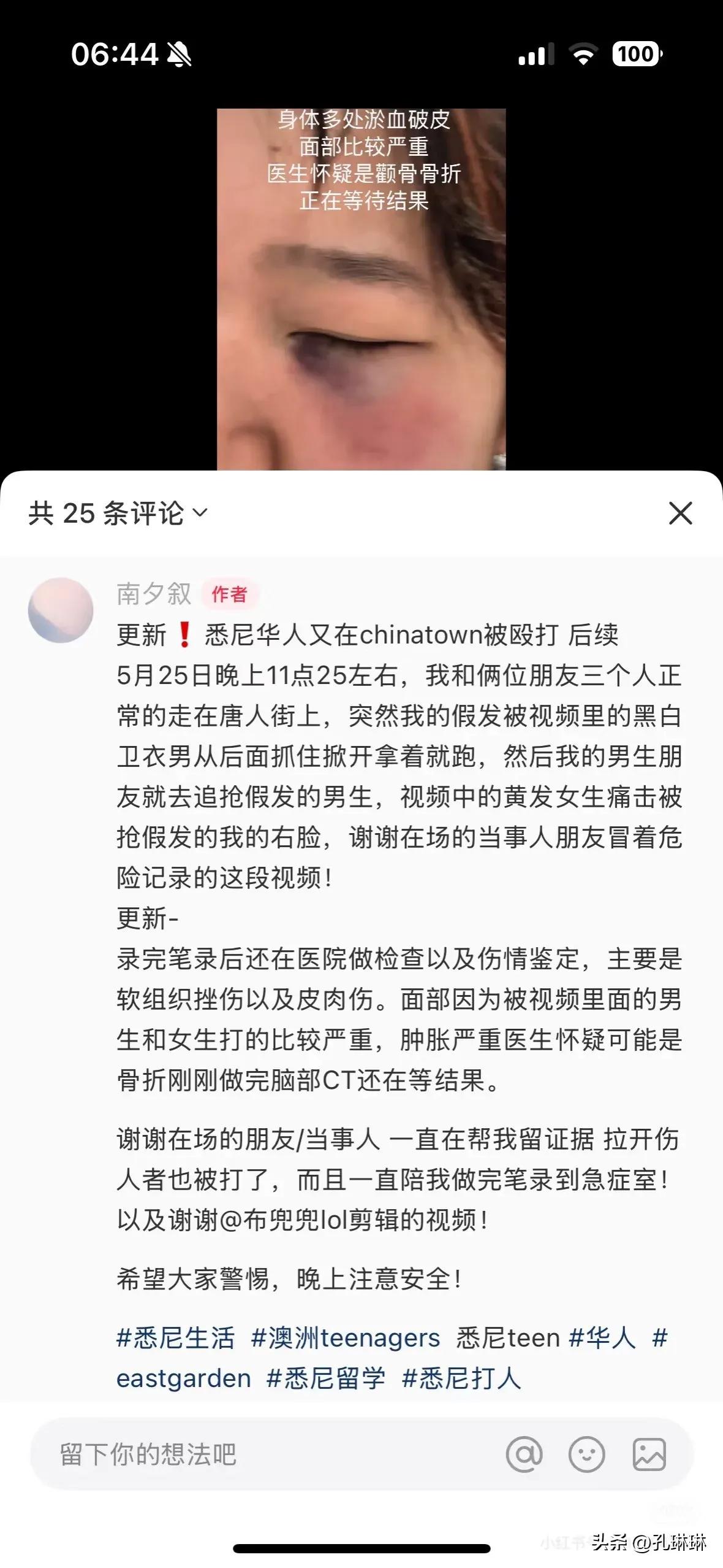 网友爆料，在澳大利亚悉尼，中国留学生、华人遭到无缘无故、恶作剧般的殴打，已经成了