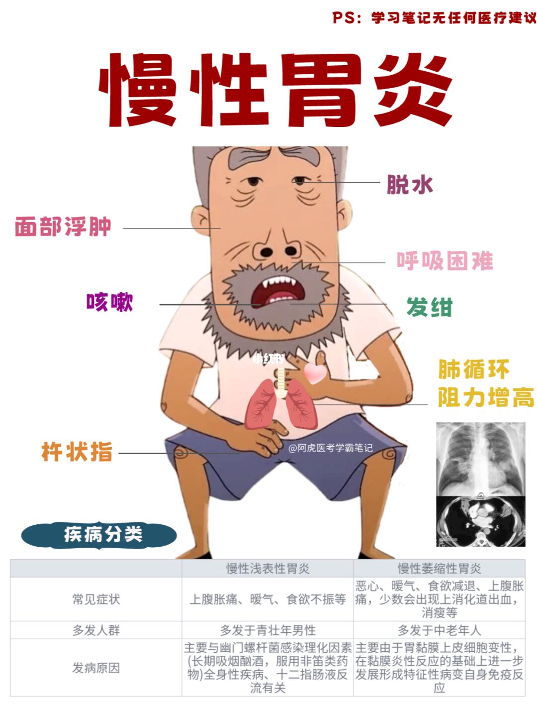 阿虎医考学霸笔记：当牛爷爷得了慢性胃炎