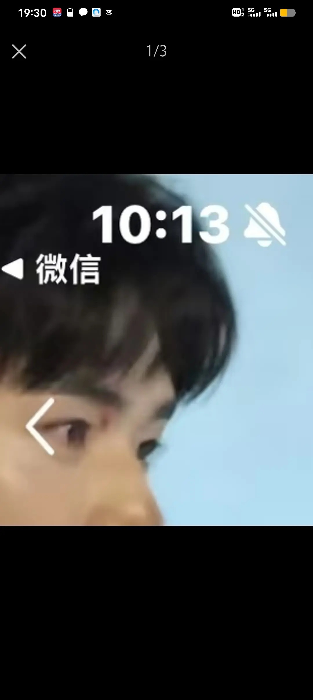 啊？龚俊戴墨镜原因是录地球超新鲜眼周受伤了？ 