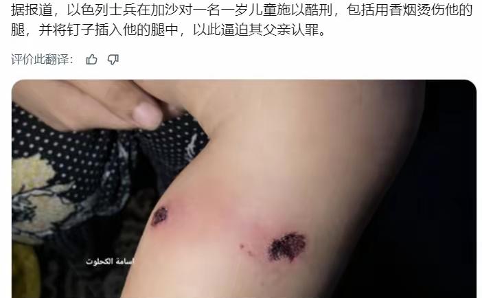 看完这段消息，气得浑身发抖，这根本不是战争，是突破人性底线的暴行。
 
加沙中部