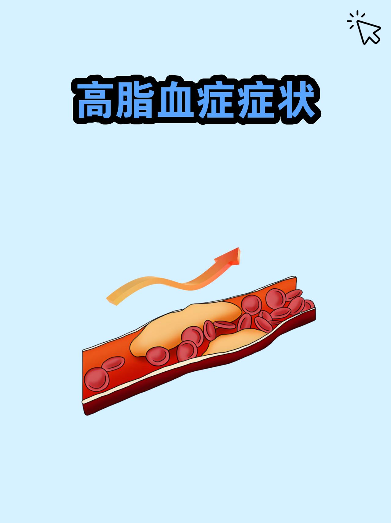 血脂偏高不痛不痒，却是血管堵塞的 “元凶”
高血脂素来被称作“无声的杀手”，多数