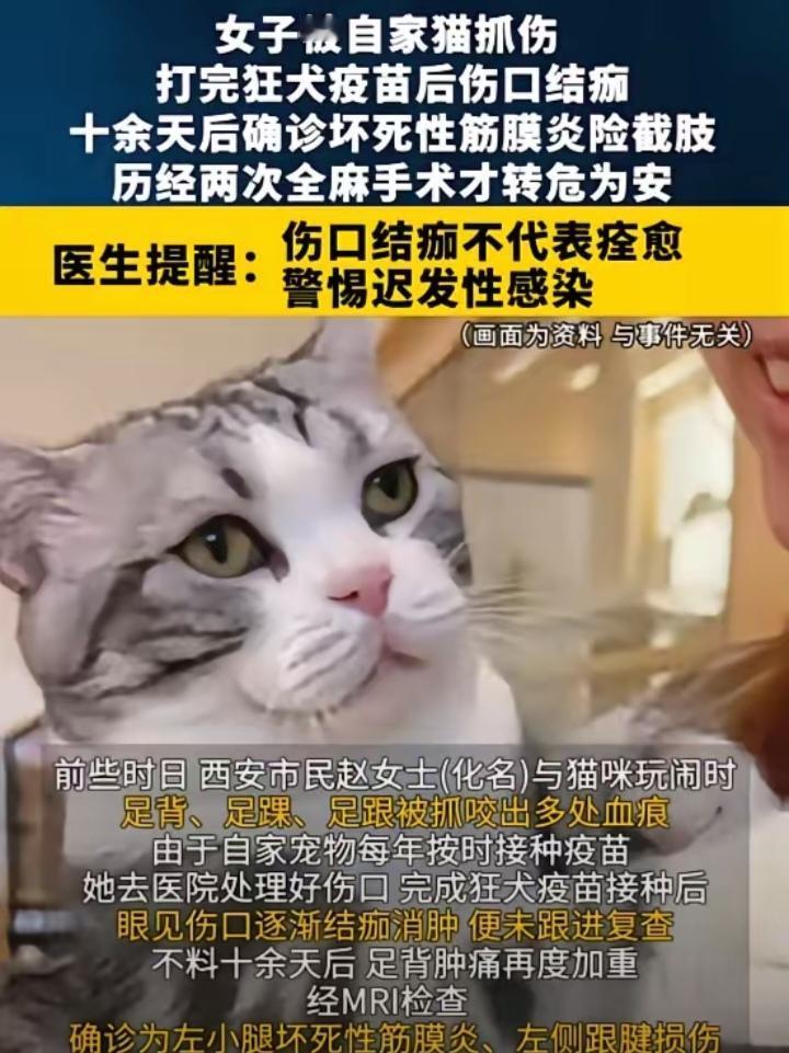 “悲剧还是发生了!"8月12日报道，陕西西安，一女子被自家猫抓伤，她打完狂犬疫苗